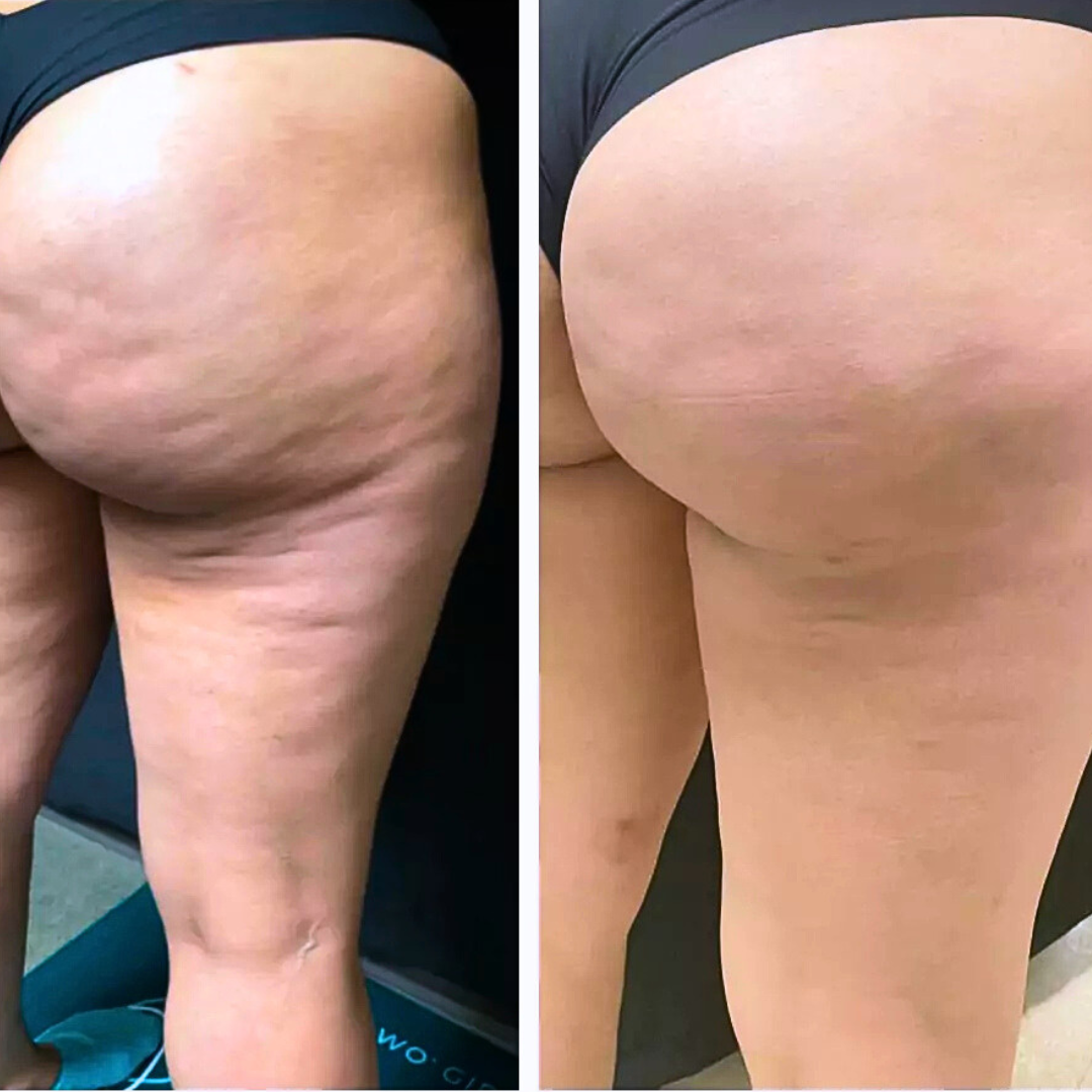 עיצוב ללא שם (9).png__PID:252ca513-e0d7-42af-a7a5-5cdd84c522b1